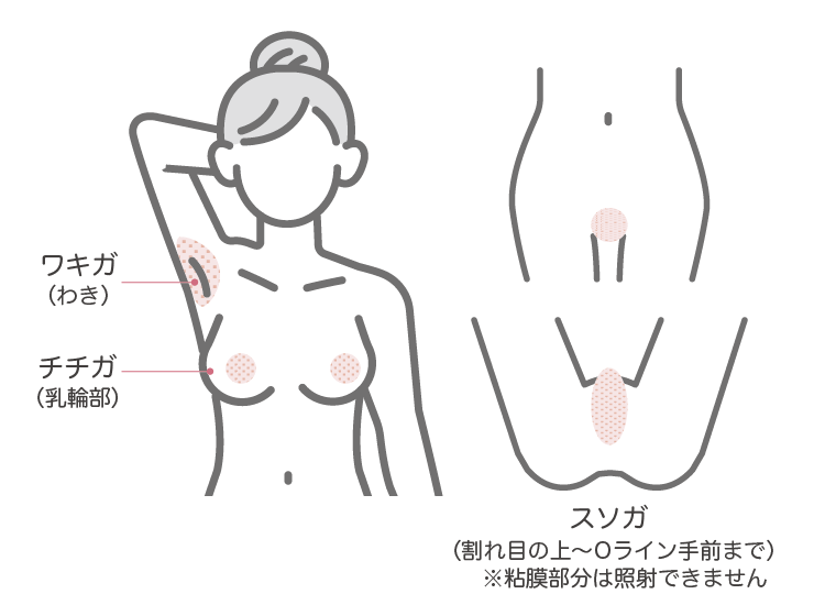 ビューホットの照射範囲